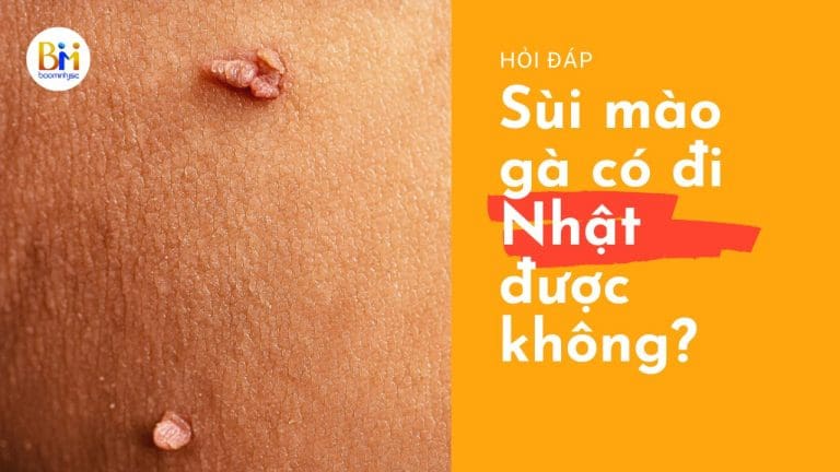 bị sùi mào gà có đi nhật được không?